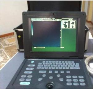 Ecografo portatil tipo Lapto cms 600p con impresora sony