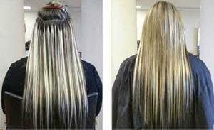 extensiones