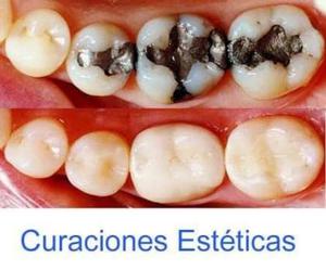 Curación Dental Dientes