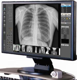 RADIOLOGIA DIGITAL