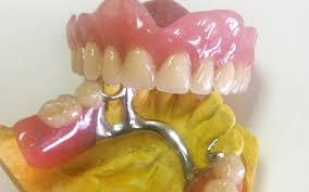 Dentaduras postizas en la comodidad de su hogar en Lima