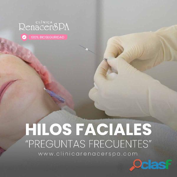 Hilos Faciales tratmiento estetico